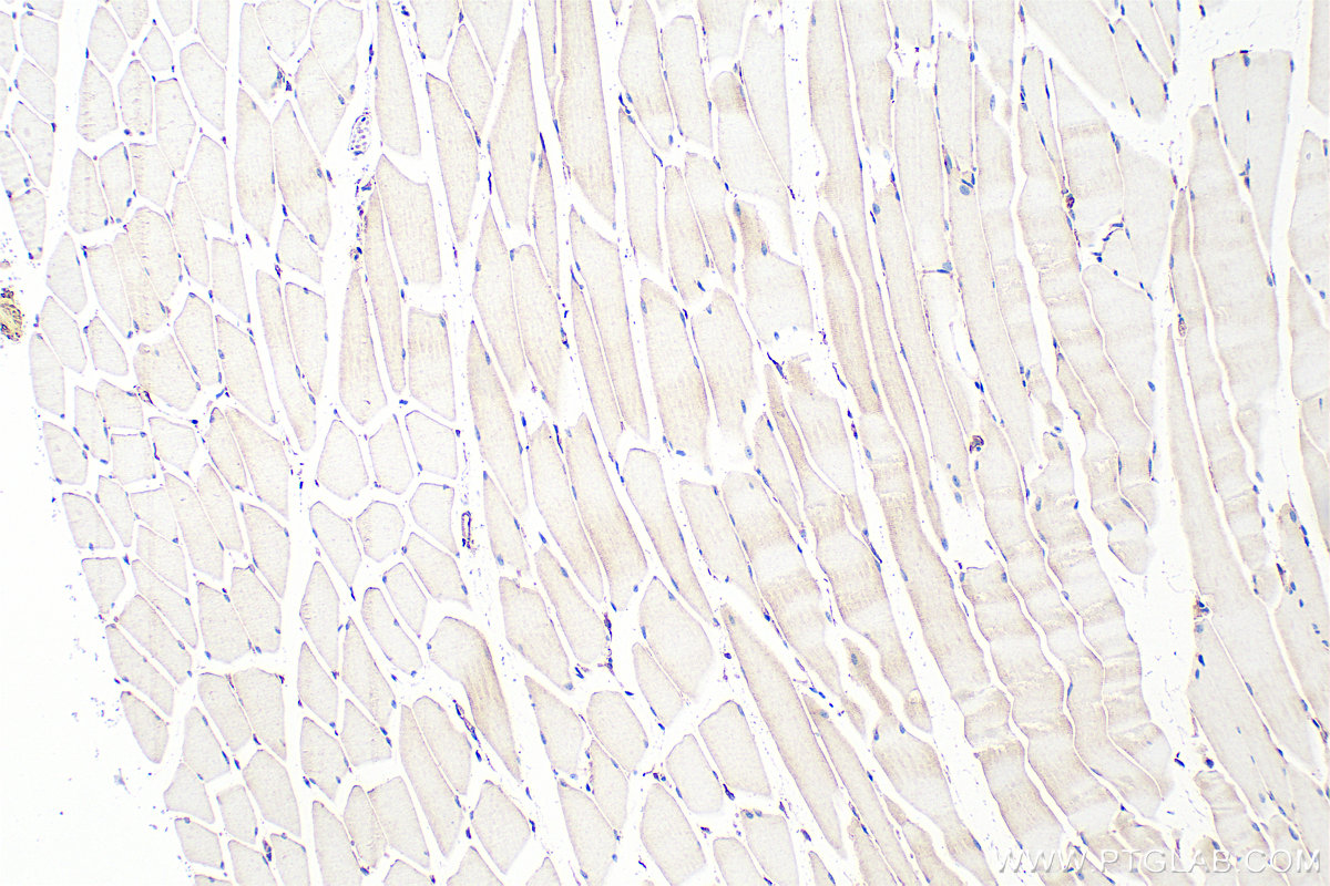Immunohistochemistry (IHC) staining of mouse skeletal muscle tissue using PDLIM5 Polyclonal antibody (10530-1-AP)