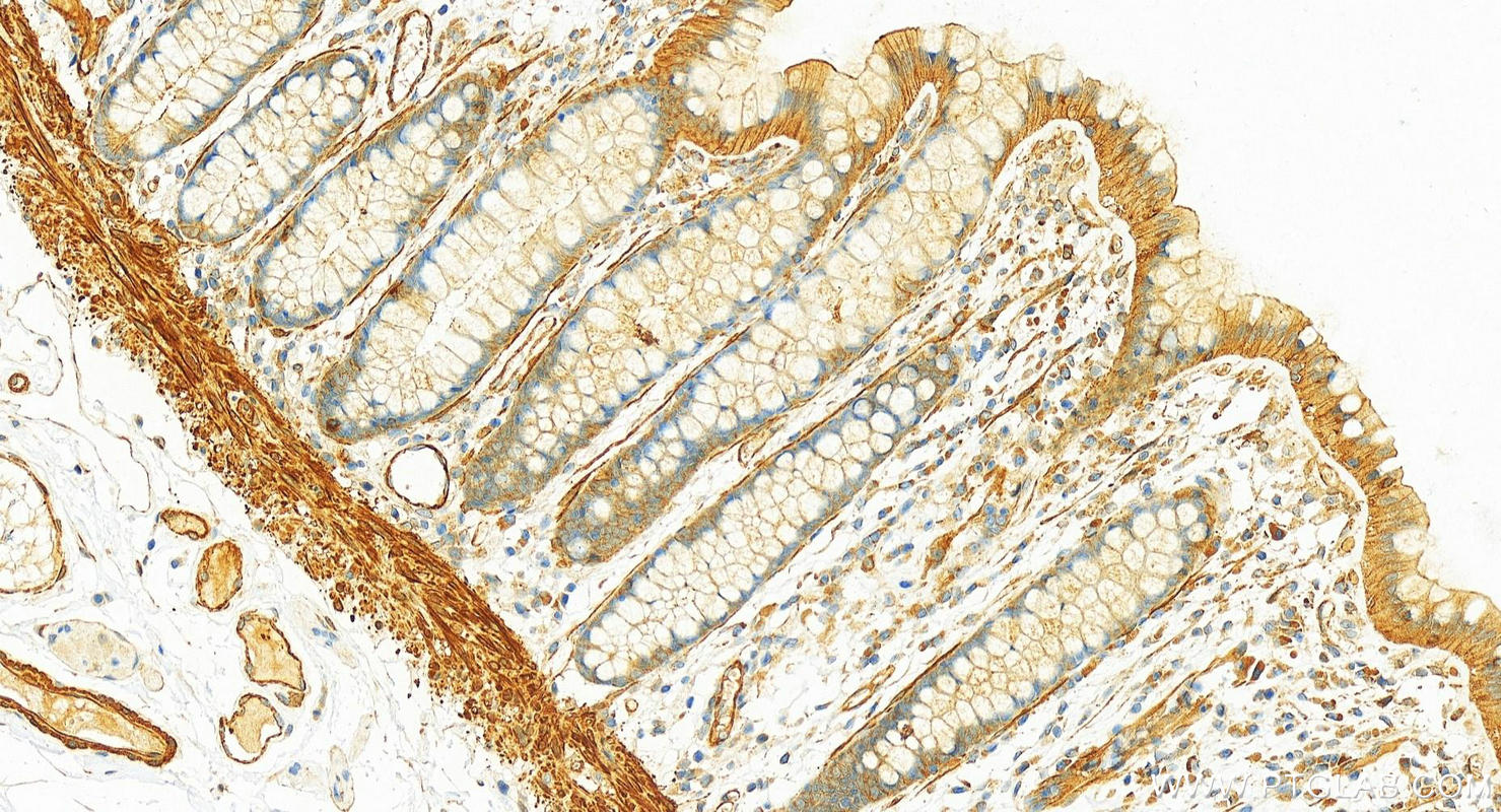 Immunohistochemistry (IHC) staining of human colon tissue using PDLIM7 Polyclonal antibody (10221-1-AP)