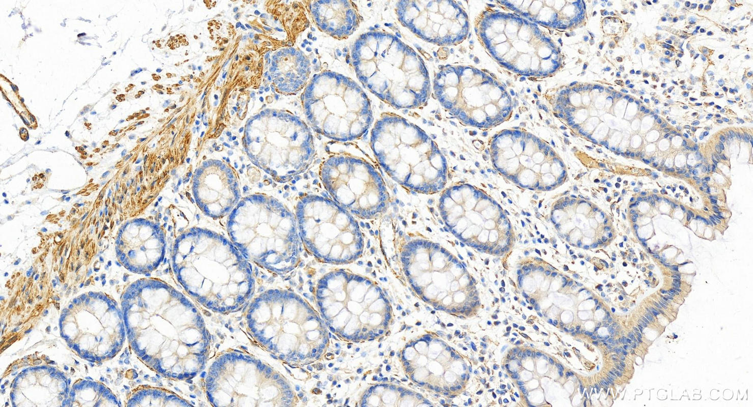 Immunohistochemistry (IHC) staining of human  colon using PDLIM7 Polyclonal antibody (17080-1-AP)