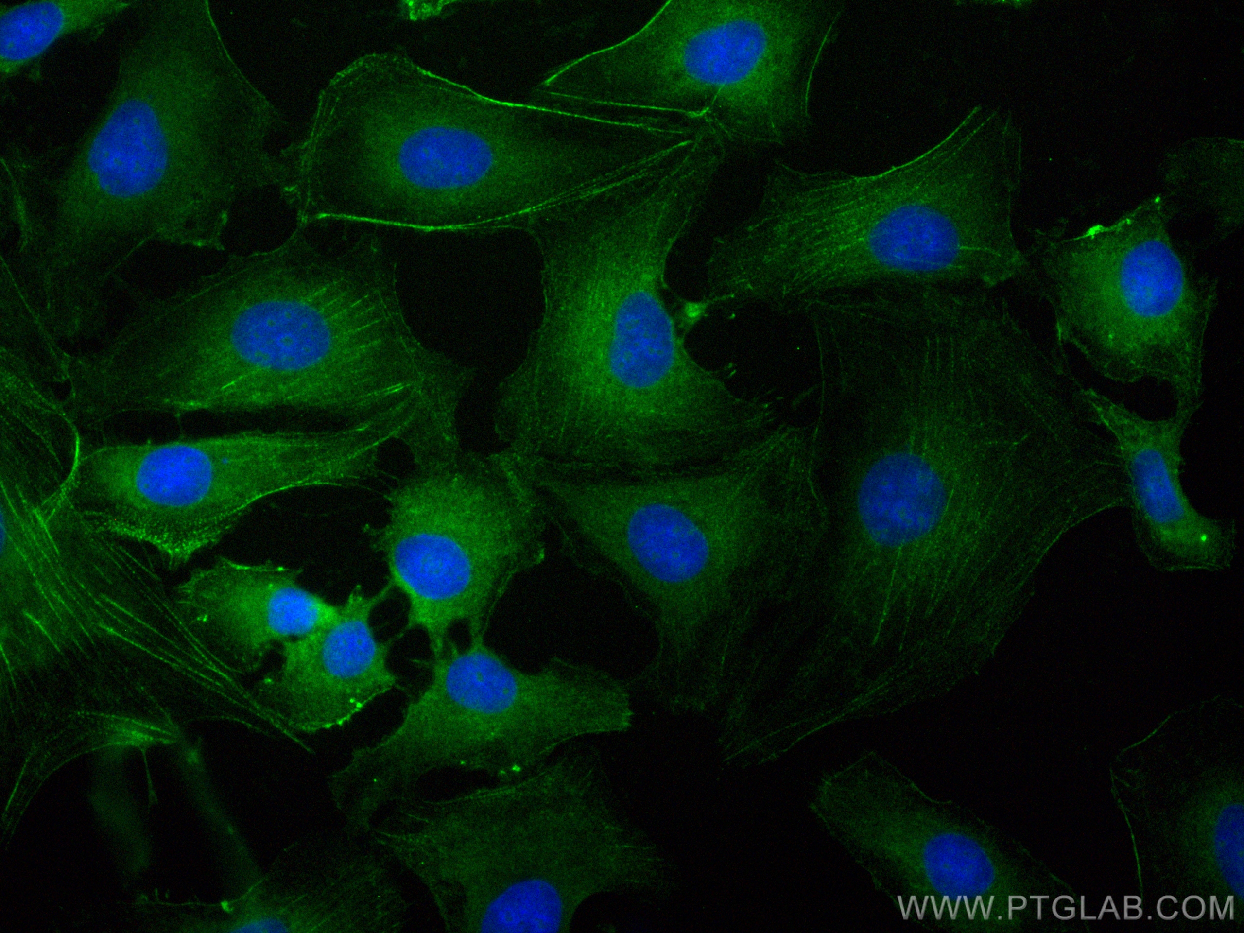 Immunofluorescence (IF) / fluorescent staining of SKOV-3 cells using CoraLite® Plus 488-conjugated PDLIM7 Polyclonal an (CL488-10221)