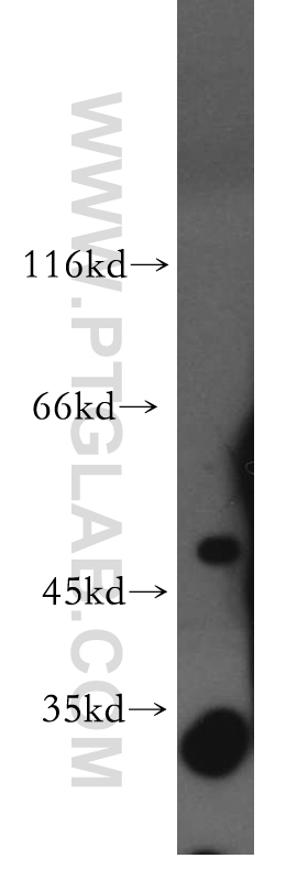 Western Blot (WB) analysis of HeLa cells using PDP2 Polyclonal antibody (13404-1-AP)