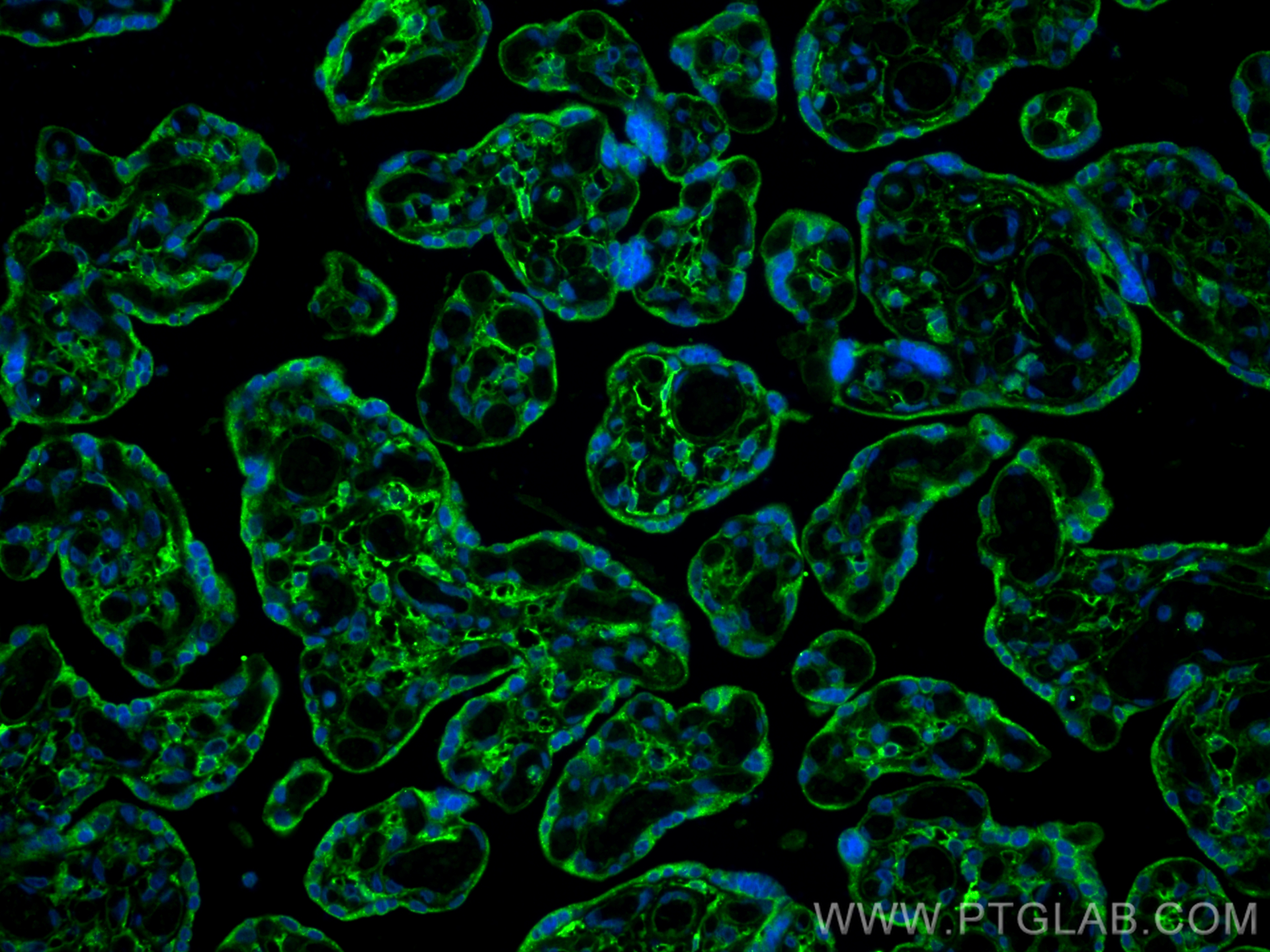 Immunofluorescence (IF) / fluorescent staining of human placenta tissue using Podoplanin Polyclonal antibody (22099-1-AP)