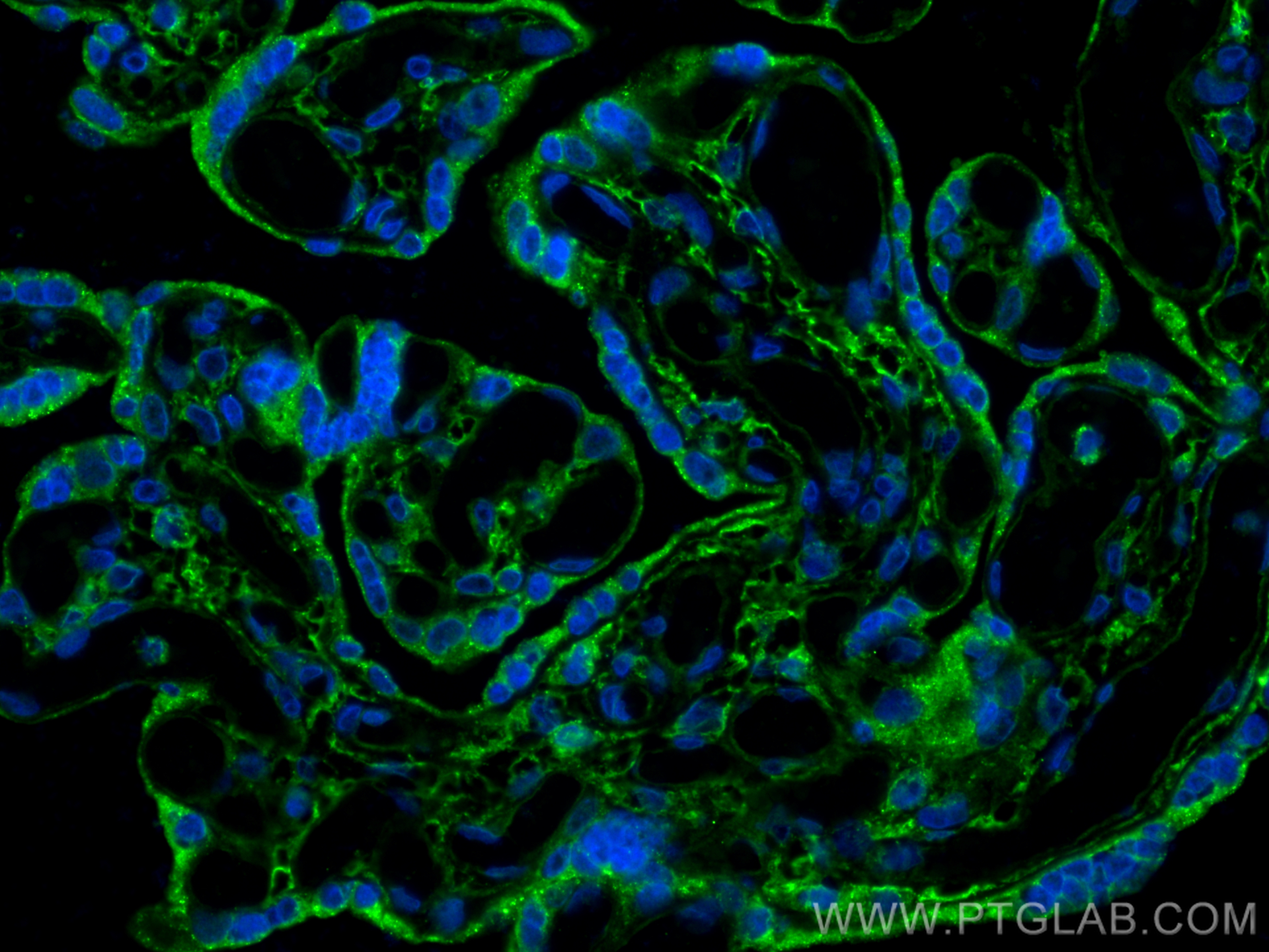 Immunofluorescence (IF) / fluorescent staining of human placenta tissue using Podoplanin Polyclonal antibody (22099-1-AP)