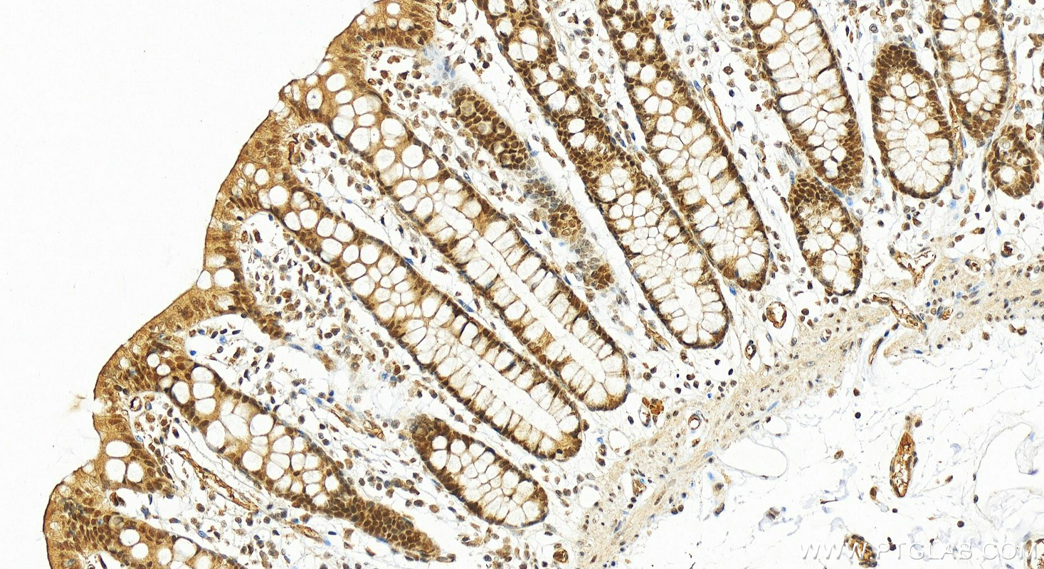 Immunohistochemistry (IHC) staining of human colon tissue using PDS5A Polyclonal antibody (17485-1-AP)