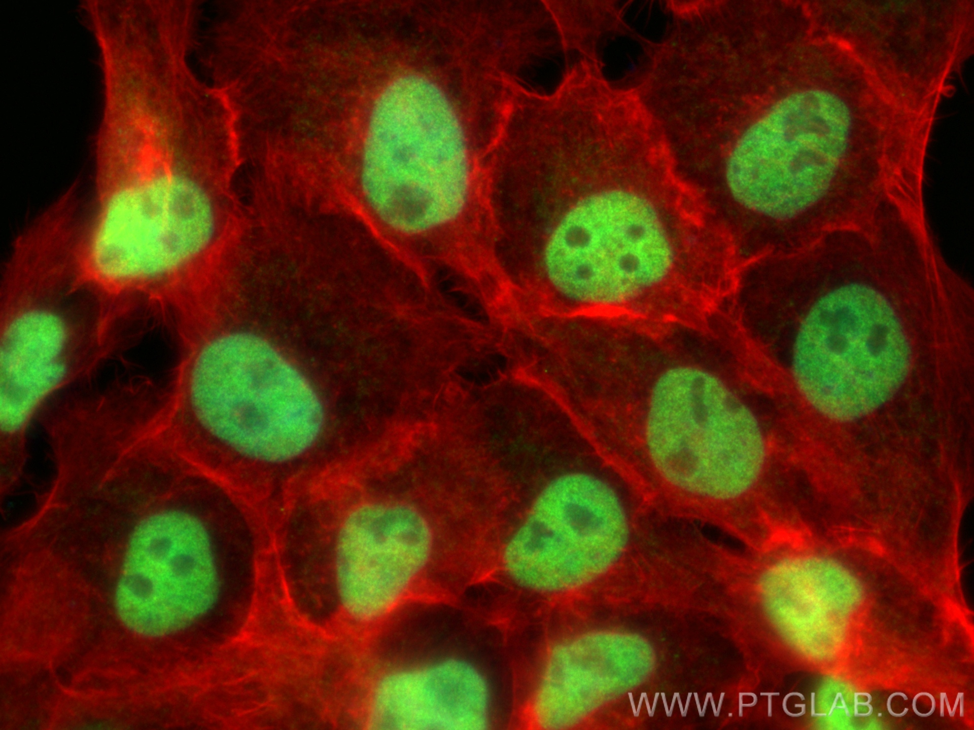 Immunofluorescence (IF) / fluorescent staining of A431 cells using PDS5A Polyclonal antibody (17485-1-AP)