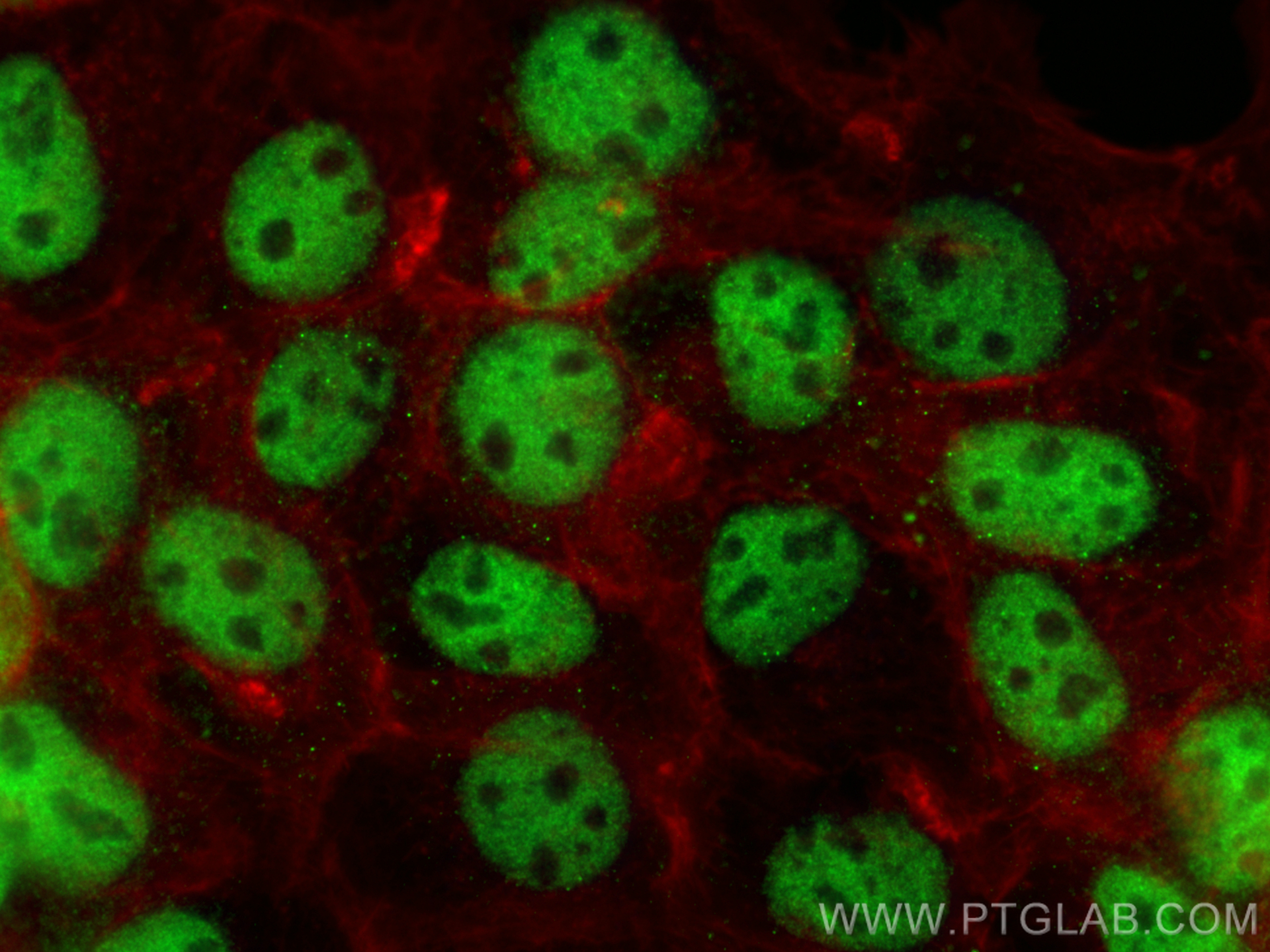 Immunofluorescence (IF) / fluorescent staining of A431 cells using PDS5A Monoclonal antibody (67520-1-Ig)