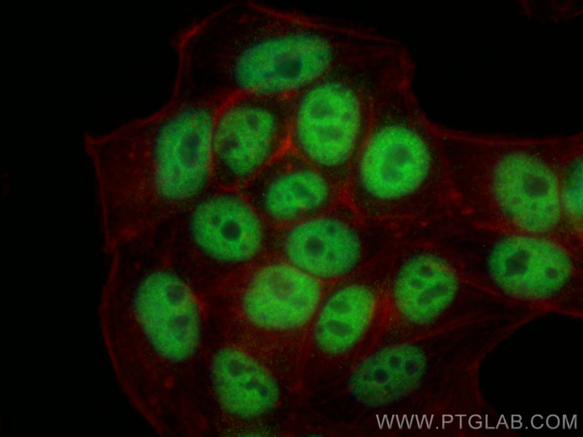 Immunofluorescence (IF) / fluorescent staining of HepG2 cells using PDS5A Monoclonal antibody (67520-1-Ig)