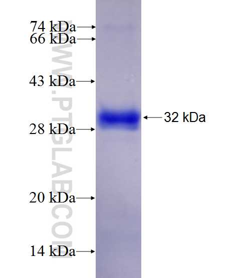 PDSS2 fusion protein Ag27522 SDS-PAGE