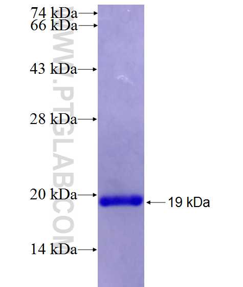 PDXP fusion protein Ag26655 SDS-PAGE