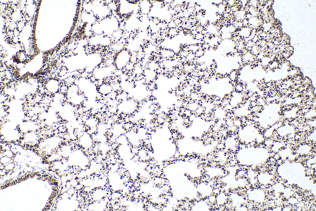 Immunohistochemistry (IHC) staining of mouse lung tissue using PDZD2 Polyclonal antibody (30191-1-AP)