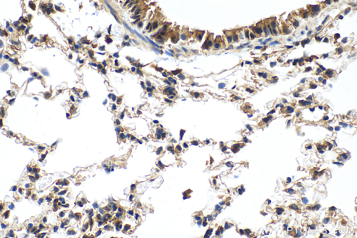 Immunohistochemistry (IHC) staining of mouse lung tissue using PDZD2 Polyclonal antibody (30191-1-AP)