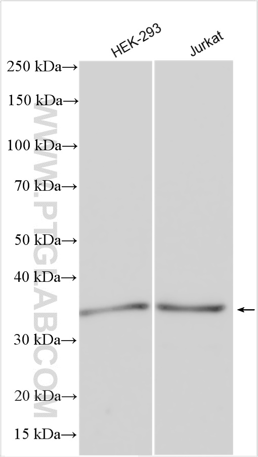 Western Blot (WB) analysis of various lysates using PDZD2 Polyclonal antibody (30191-1-AP)