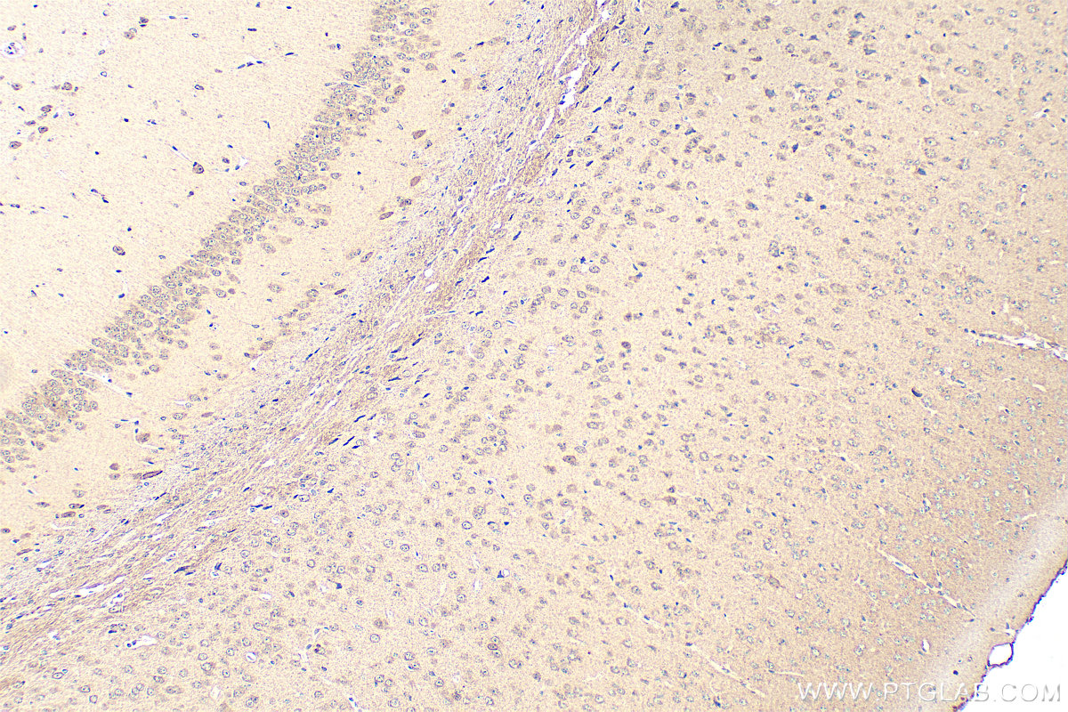 Immunohistochemistry (IHC) staining of mouse brain tissue using PDZD4 Polyclonal antibody (20167-1-AP)