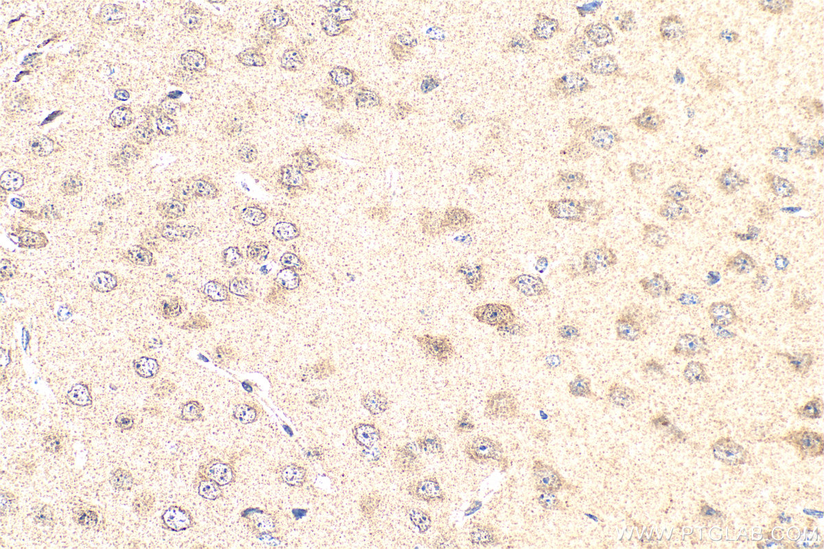 Immunohistochemistry (IHC) staining of mouse brain tissue using PDZD4 Polyclonal antibody (20167-1-AP)