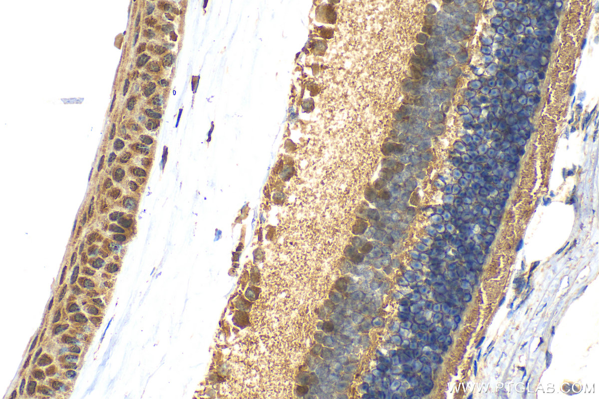 Immunohistochemistry (IHC) staining of mouse eye tissue using PDZD7 Polyclonal antibody (21084-1-AP)