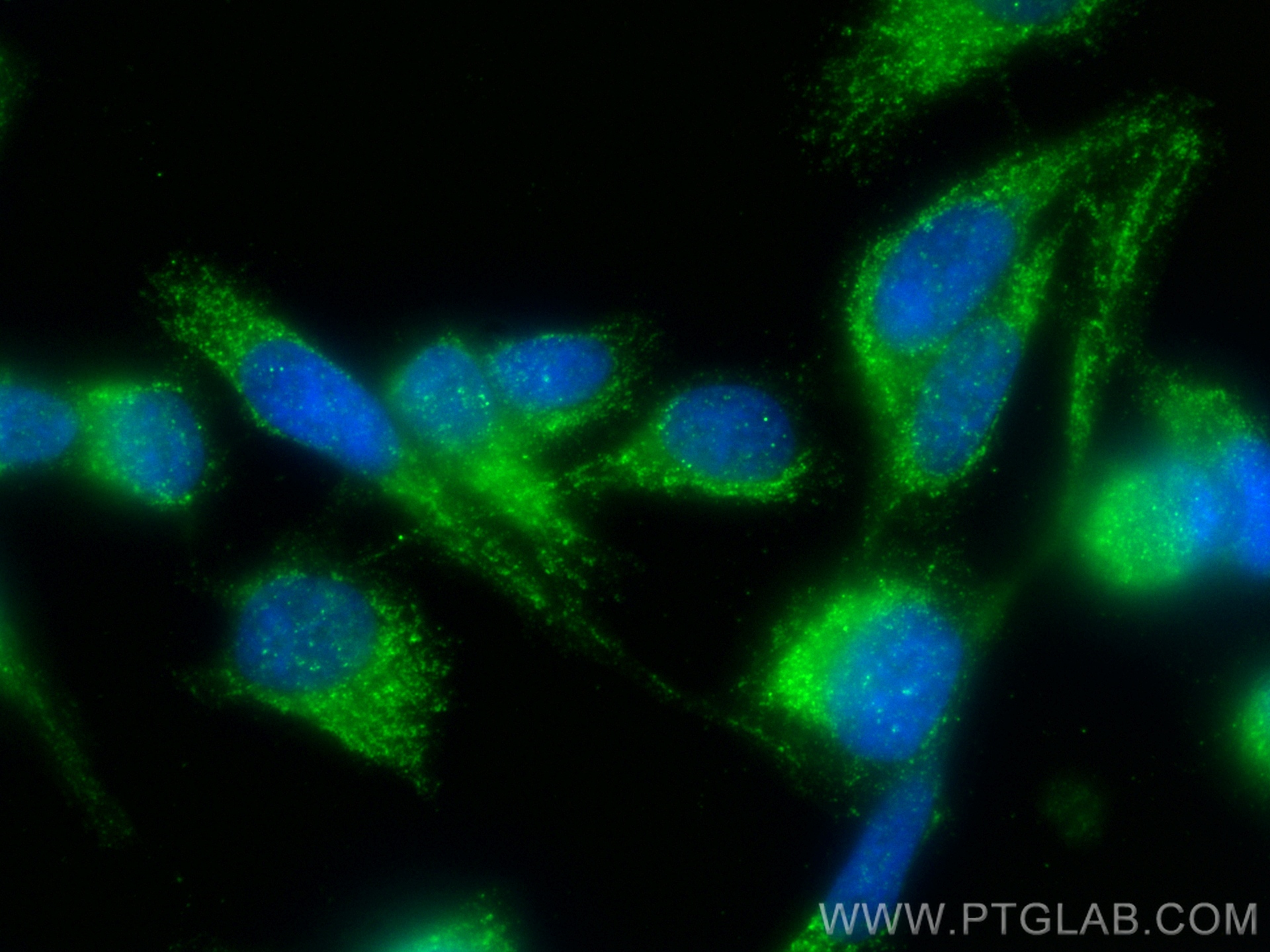 Immunofluorescence (IF) / fluorescent staining of PC-3 cells using MAP17 / PDZK1IP1 Polyclonal antibody (12518-1-AP)