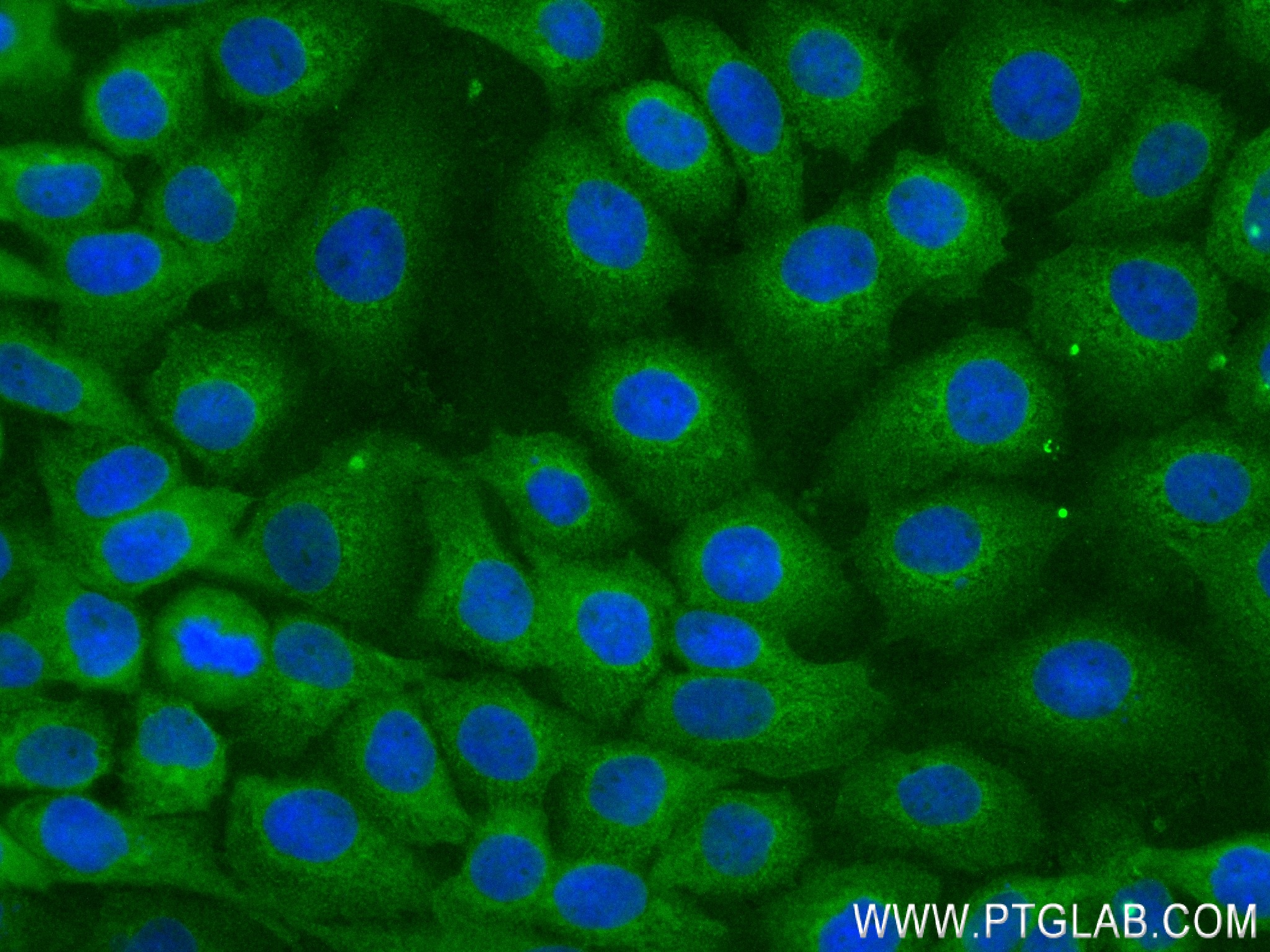 Immunofluorescence (IF) / fluorescent staining of A431 cells using PEA15 Recombinant antibody (83958-3-RR)