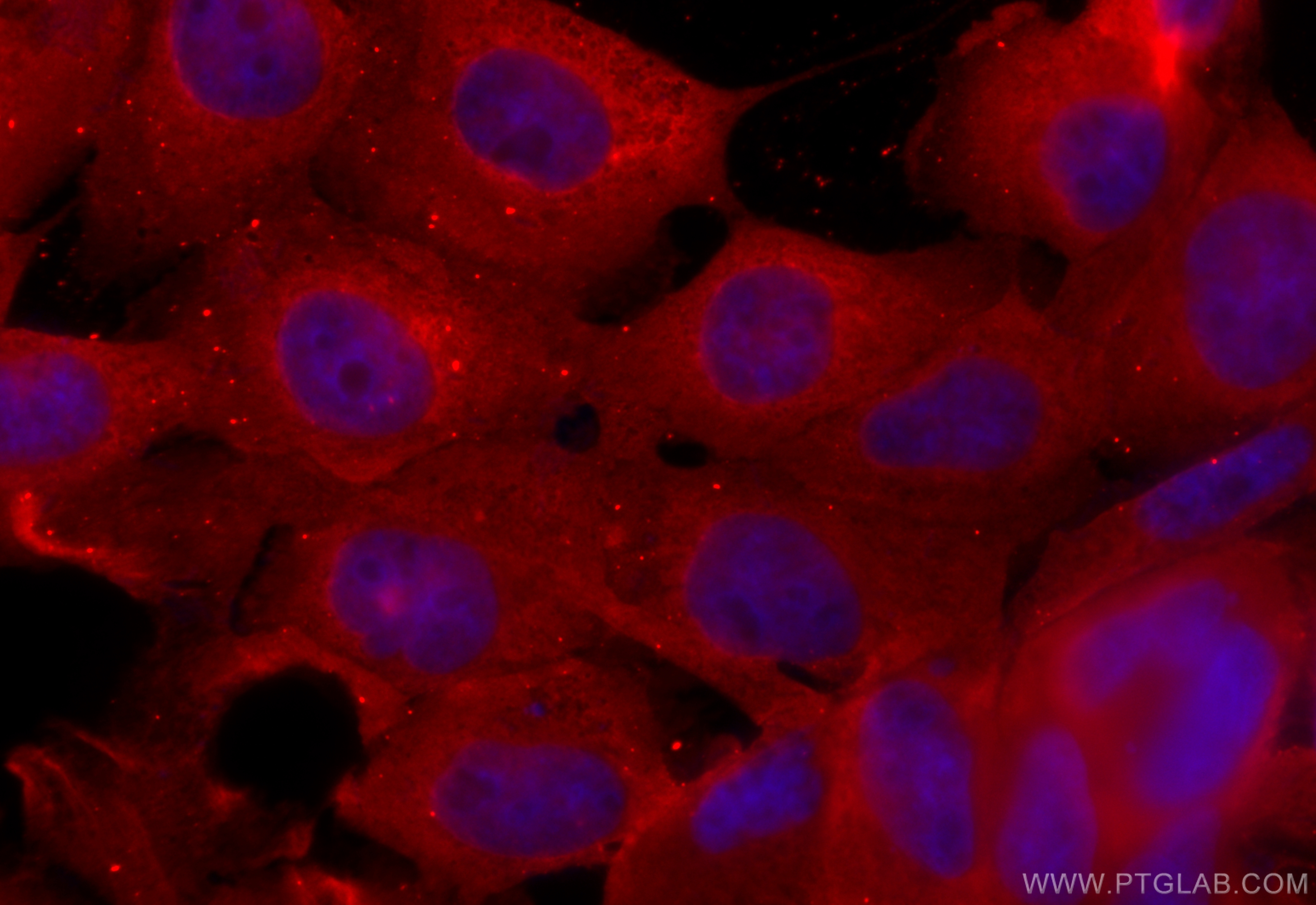 Immunofluorescence (IF) / fluorescent staining of A431 cells using PEA15 Recombinant antibody (83958-3-RR)