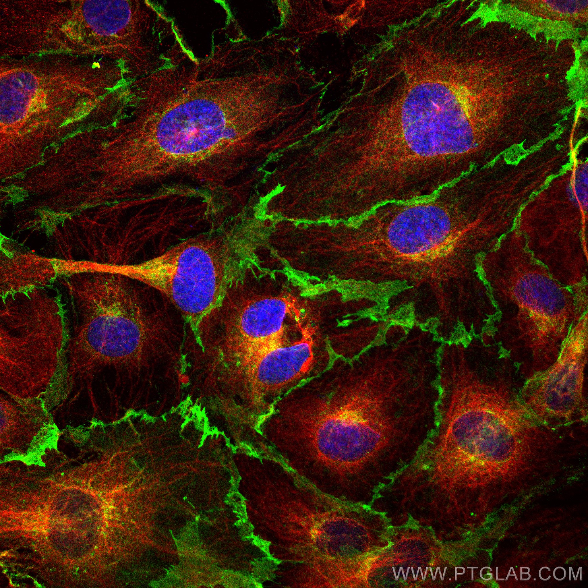 Immunofluorescence (IF) / fluorescent staining of HUVEC cells using CD31 Polyclonal antibody (11265-1-AP)