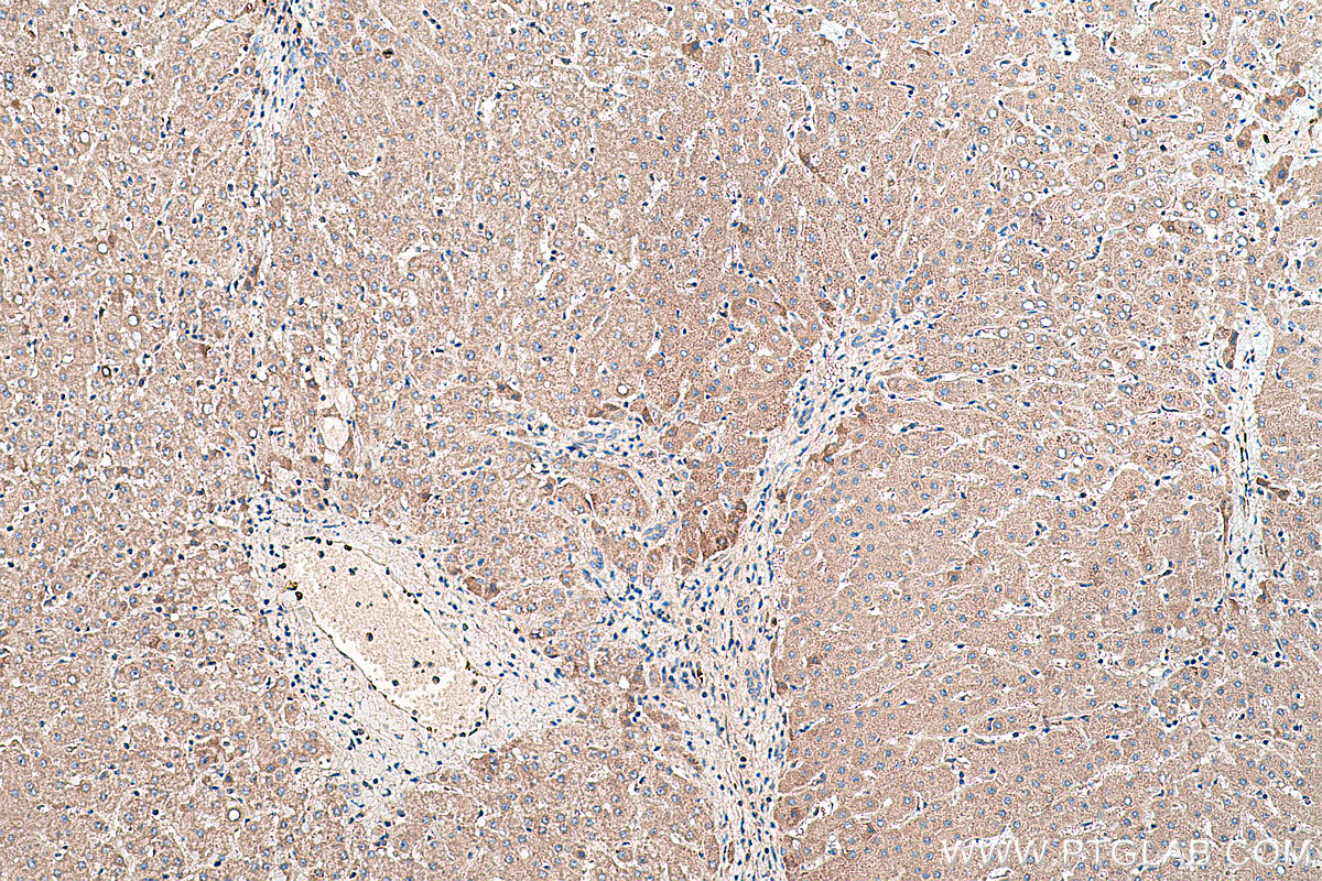 Immunohistochemistry (IHC) staining of human liver tissue using Serpin F1/PEDF Polyclonal antibody (26045-1-AP)