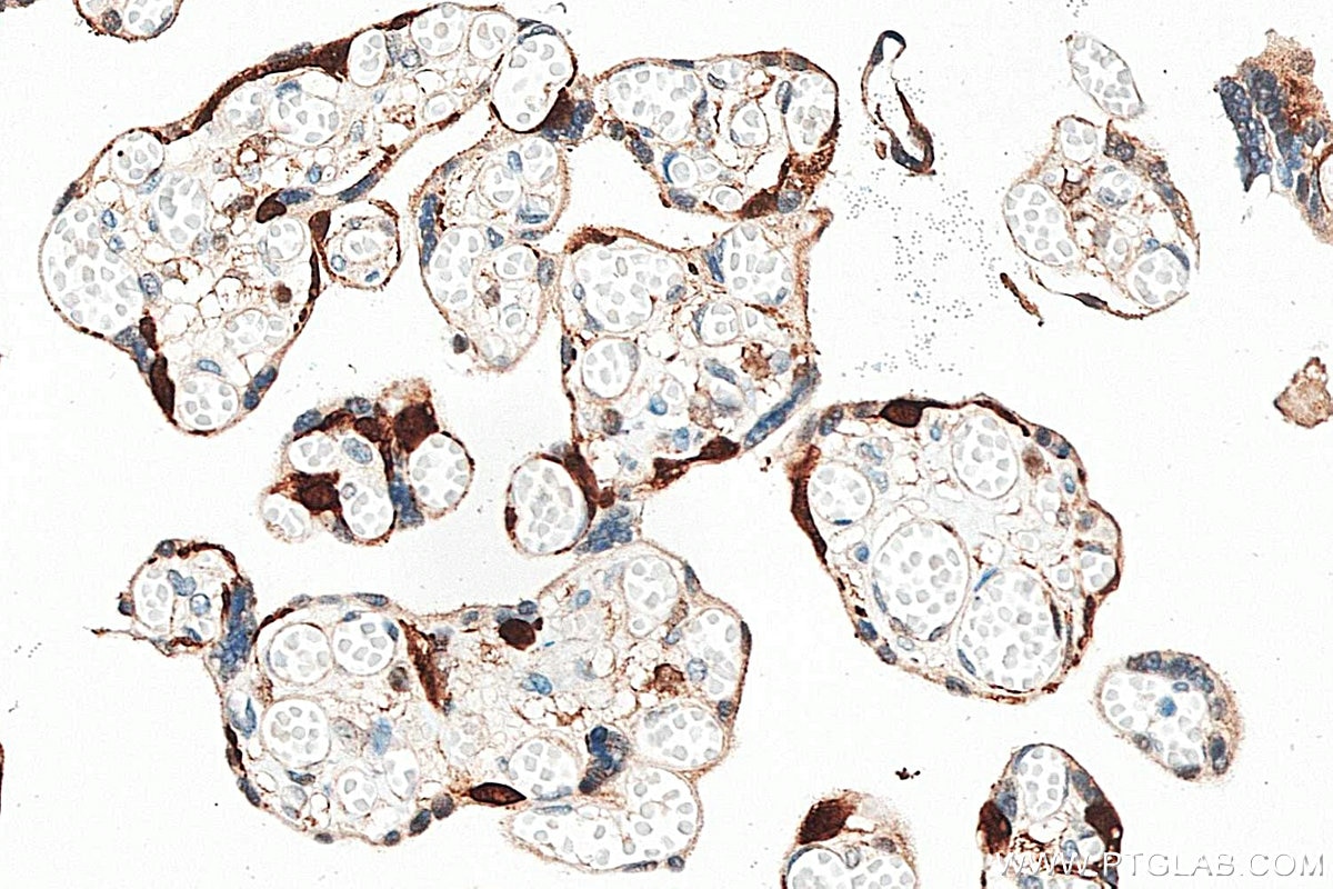 Immunohistochemistry (IHC) staining of human placenta tissue using PEG10 Polyclonal antibody (14412-1-AP)