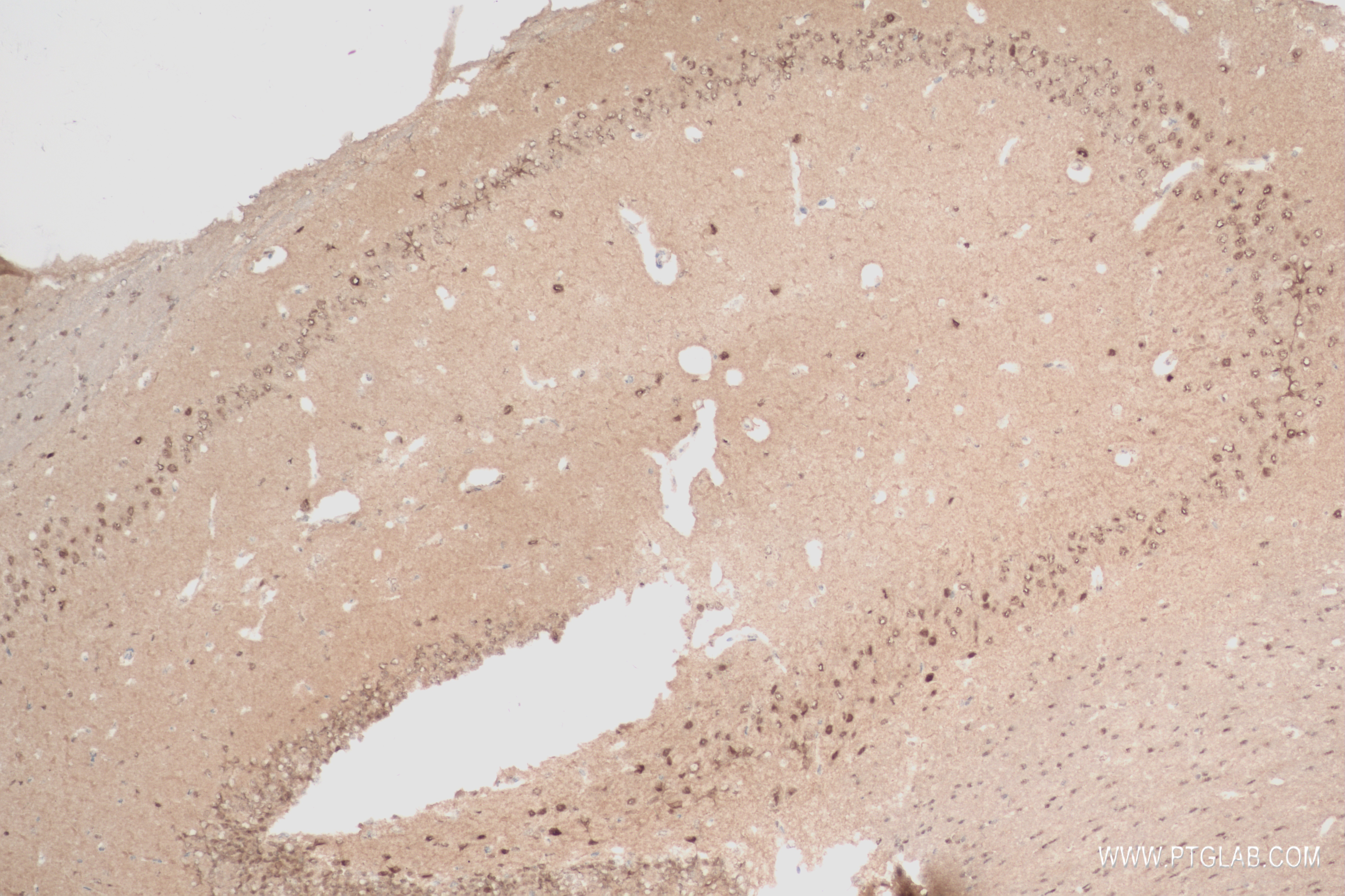 Immunohistochemistry (IHC) staining of mouse brain tissue using PEG3 Recombinant antibody (84030-5-RR)