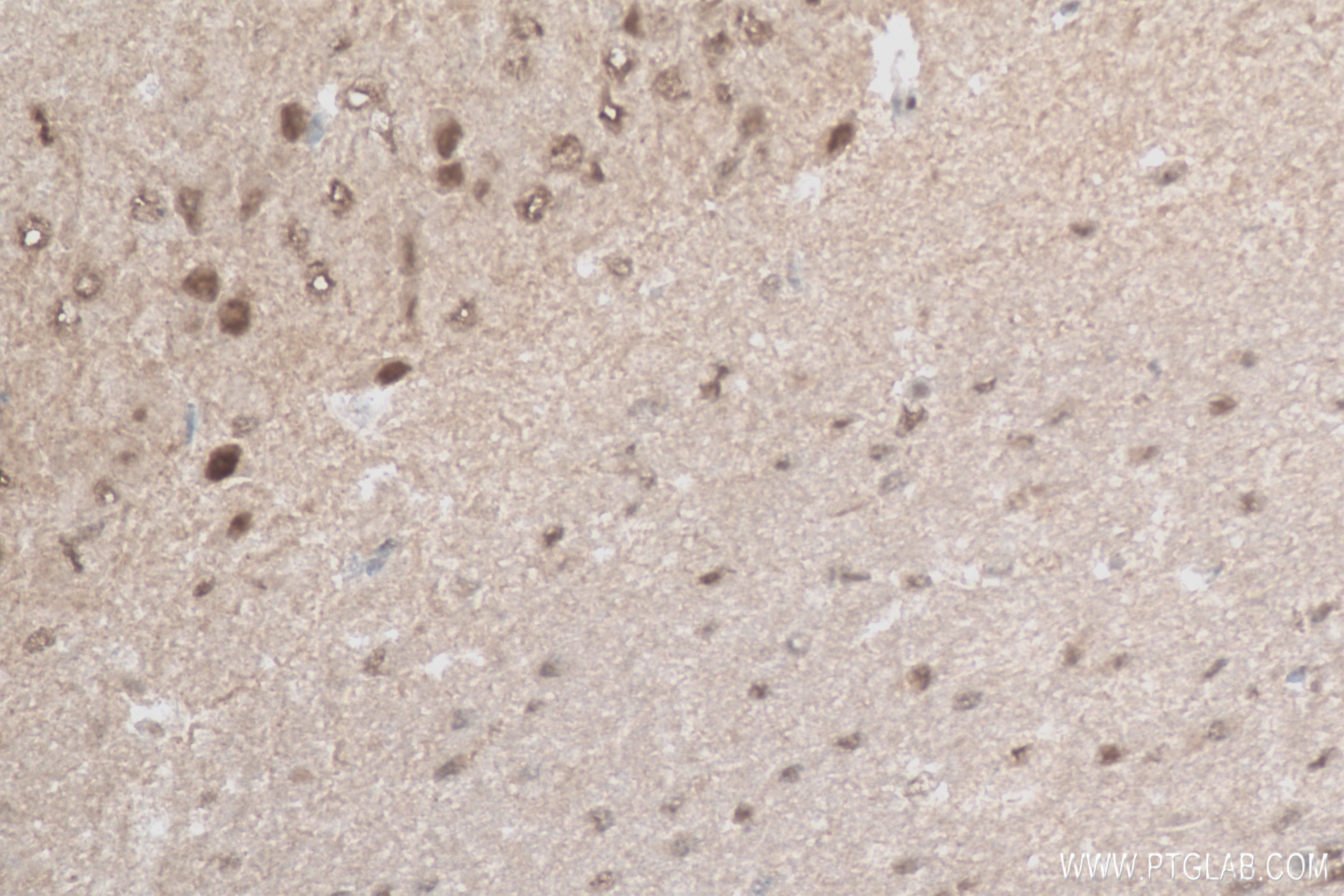 Immunohistochemistry (IHC) staining of mouse brain tissue using PEG3 Recombinant antibody (84030-5-RR)