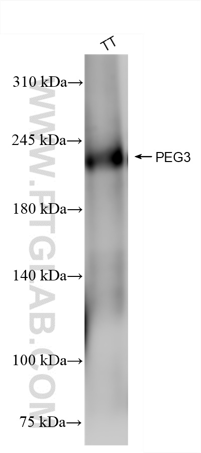 Western Blot (WB) analysis of TT cells using PEG3 Recombinant antibody (84030-5-RR)