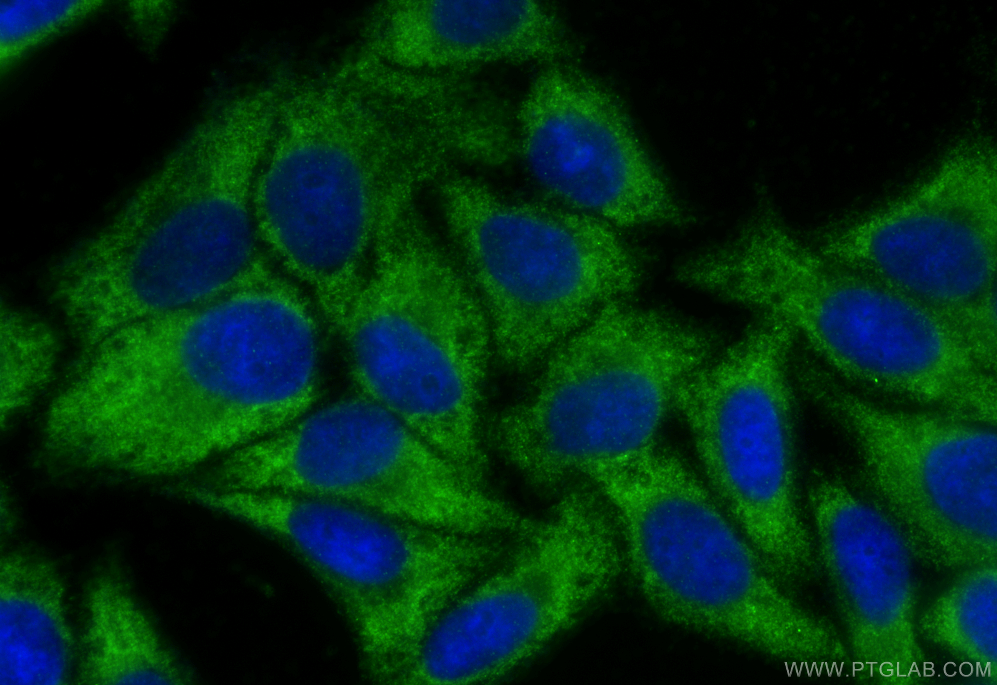 Immunofluorescence (IF) / fluorescent staining of HepG2 cells using PELI2 Polyclonal antibody (16097-1-AP)