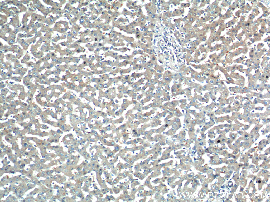 Immunohistochemistry (IHC) staining of human liver tissue using PEMT Polyclonal antibody (25916-1-AP)