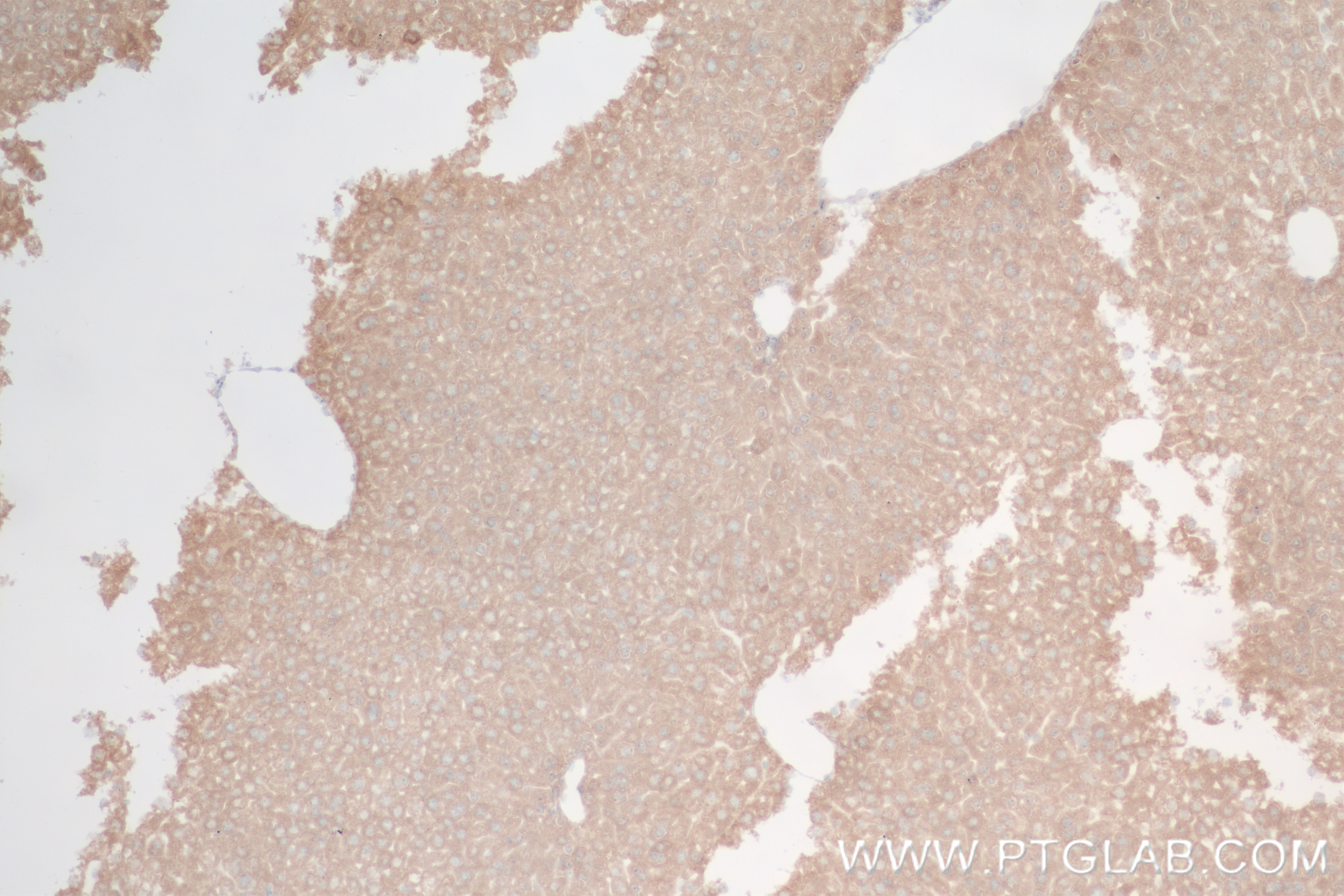 Immunohistochemistry (IHC) staining of mouse liver tissue using PEMT Recombinant antibody (85099-1-RR)