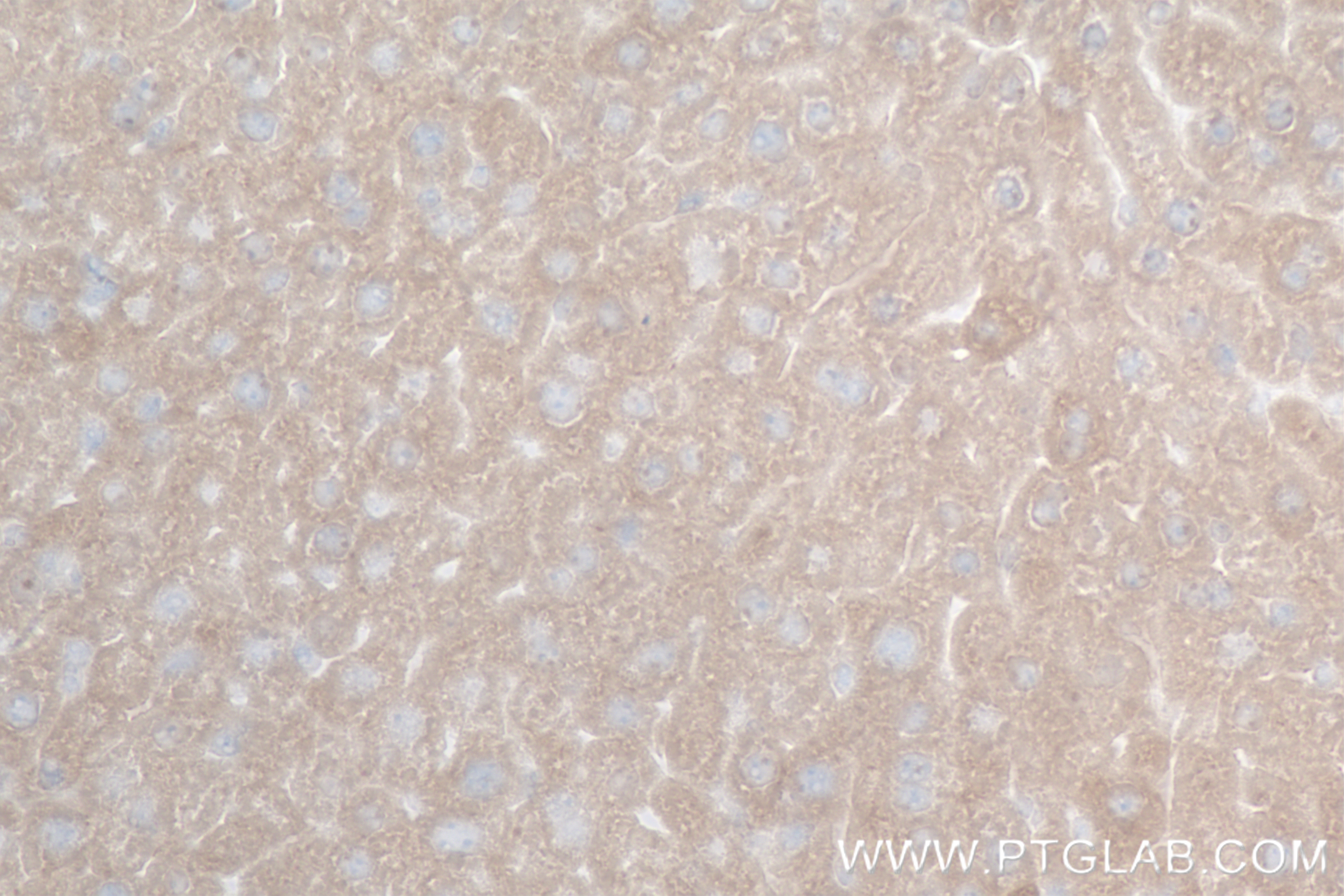 Immunohistochemistry (IHC) staining of mouse liver tissue using PEMT Recombinant antibody (85099-1-RR)