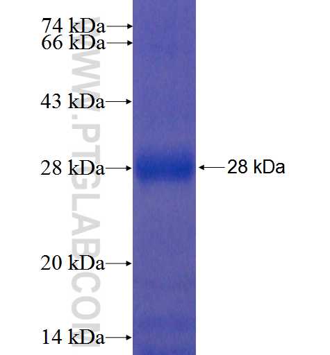 PEMT fusion protein Ag5872 SDS-PAGE