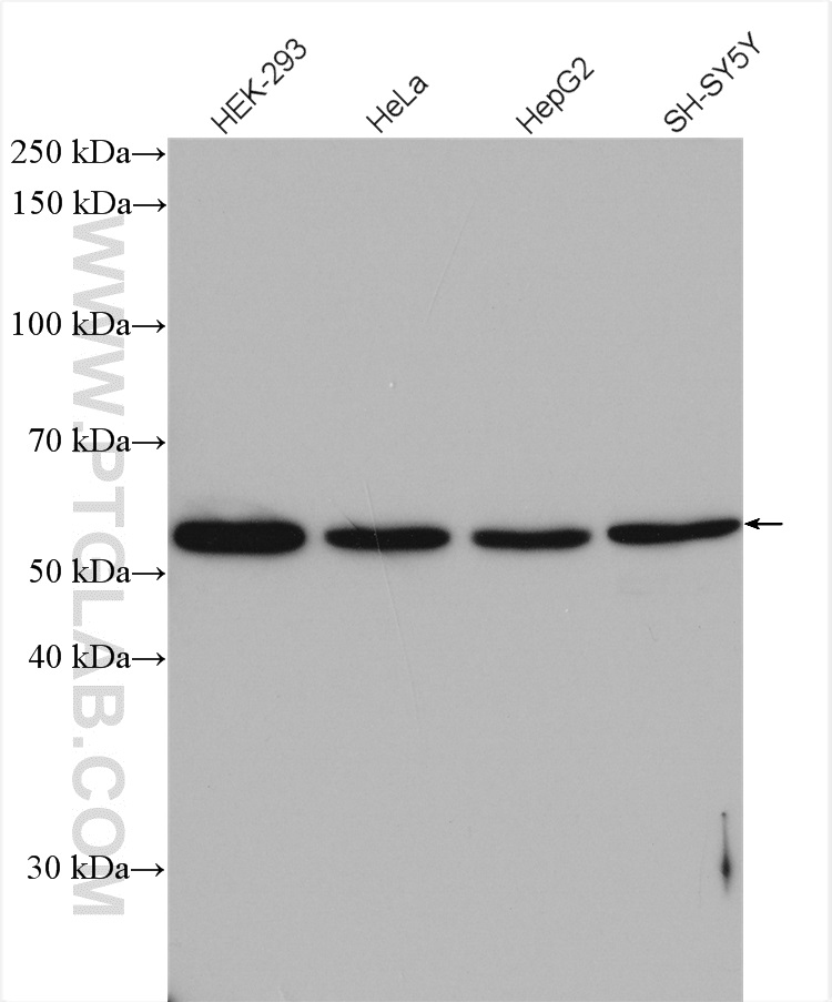 Western Blot (WB) analysis of various lysates using PEPD Polyclonal antibody (12218-1-AP)