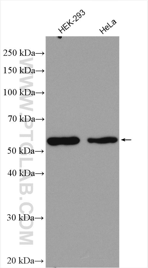 Western Blot (WB) analysis of various lysates using PEPD Polyclonal antibody (12218-1-AP)