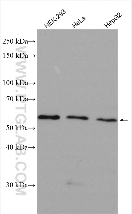 Western Blot (WB) analysis of various lysates using PEPD Polyclonal antibody (12218-1-AP)