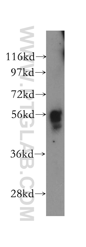 Western Blot (WB) analysis of mouse skin tissue using PEPD Polyclonal antibody (12218-1-AP)