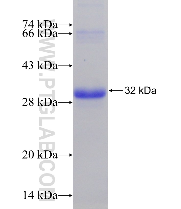 PER2 fusion protein Ag31485 SDS-PAGE