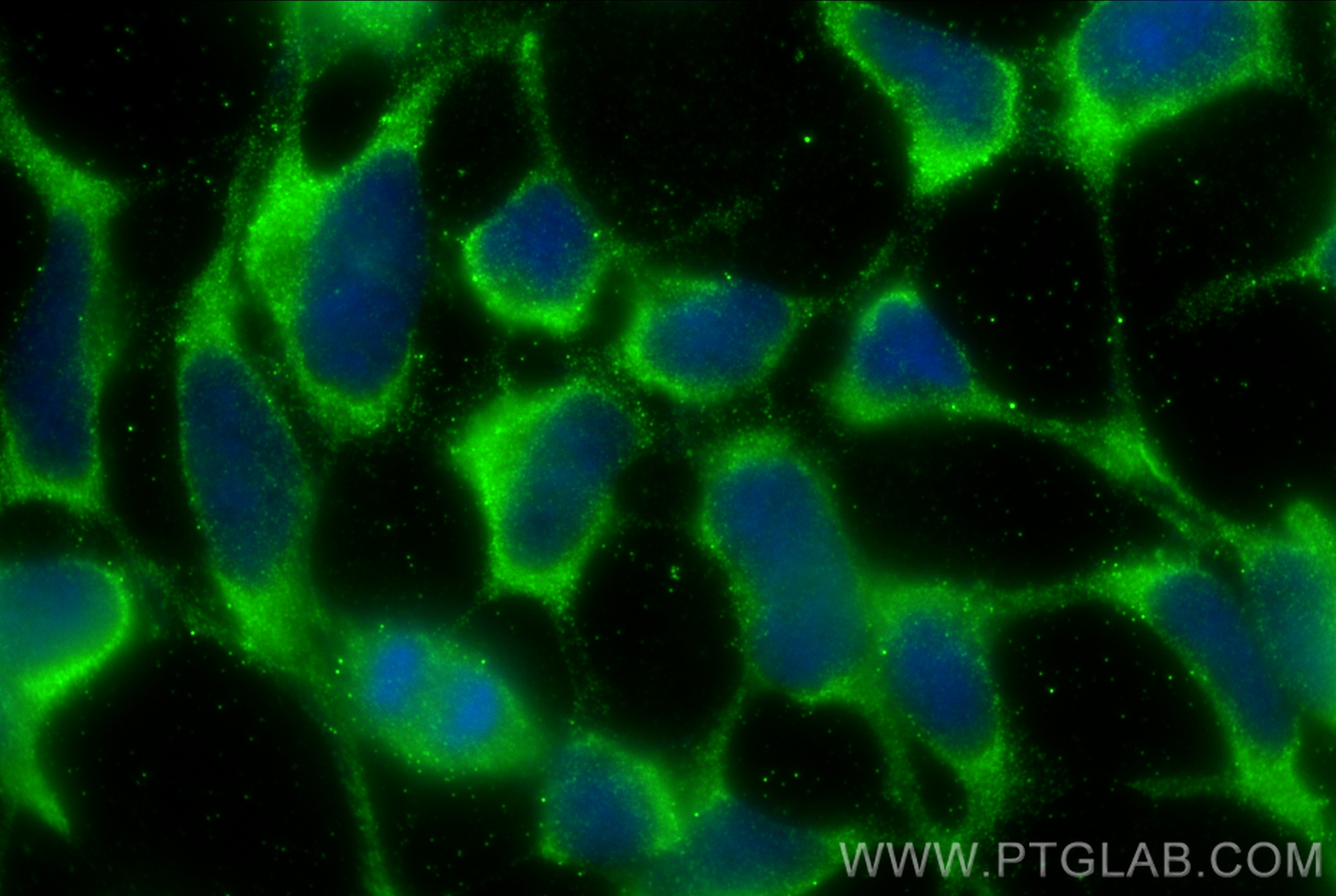 Immunofluorescence (IF) / fluorescent staining of HEK-293 cells using PERK/EIF2AK3 Polyclonal antibody (20582-1-AP)