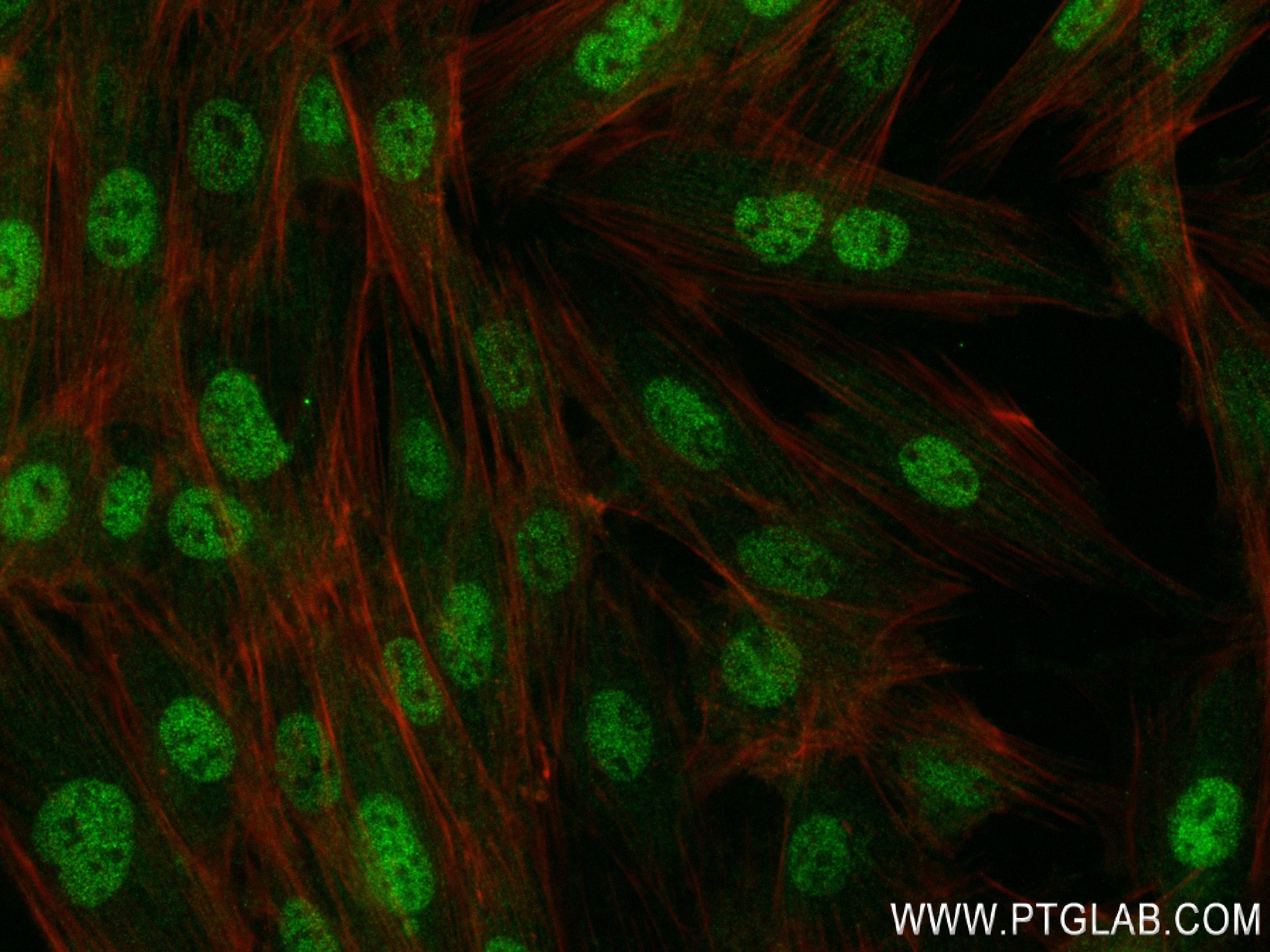 Immunofluorescence (IF) / fluorescent staining of H9C2 cells using  PERM1 Recombinant antibody (84425-5-RR)