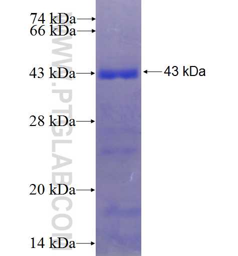 PET112L fusion protein Ag23740 SDS-PAGE