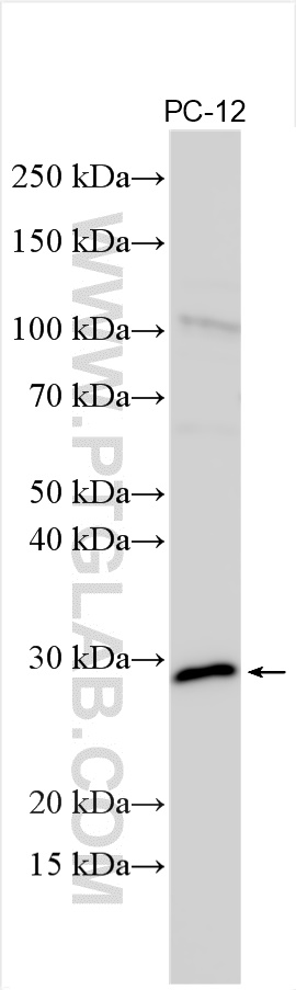 Western Blot (WB) analysis of various lysates using PEX11G Polyclonal antibody (15744-1-AP)