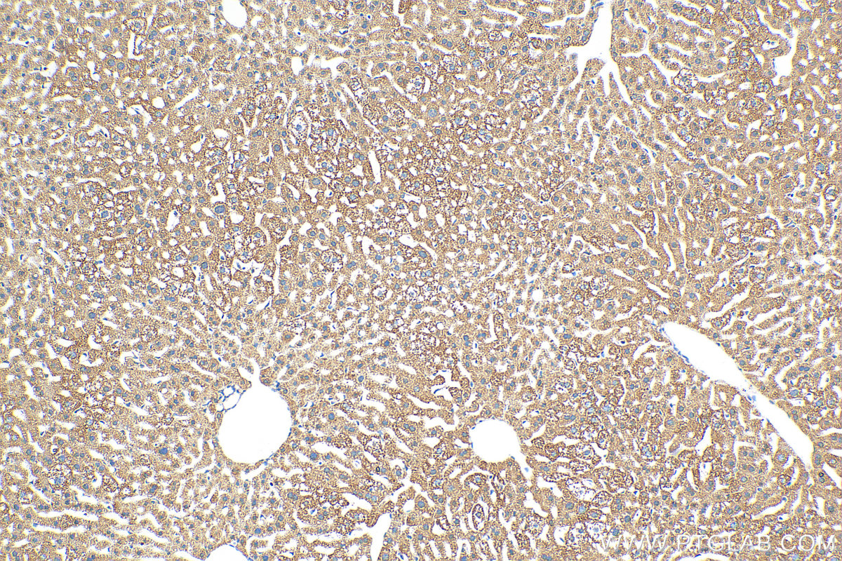 Immunohistochemistry (IHC) staining of mouse liver tissue using Biotin-conjugated PEX14 Polyclonal antibody (Biotin-10594)