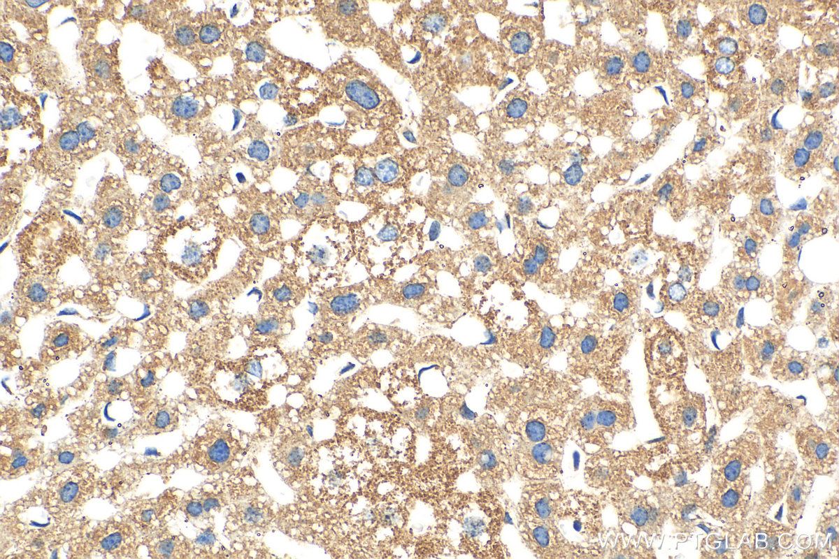 Immunohistochemistry (IHC) staining of mouse liver tissue using Biotin-conjugated PEX14 Polyclonal antibody (Biotin-10594)