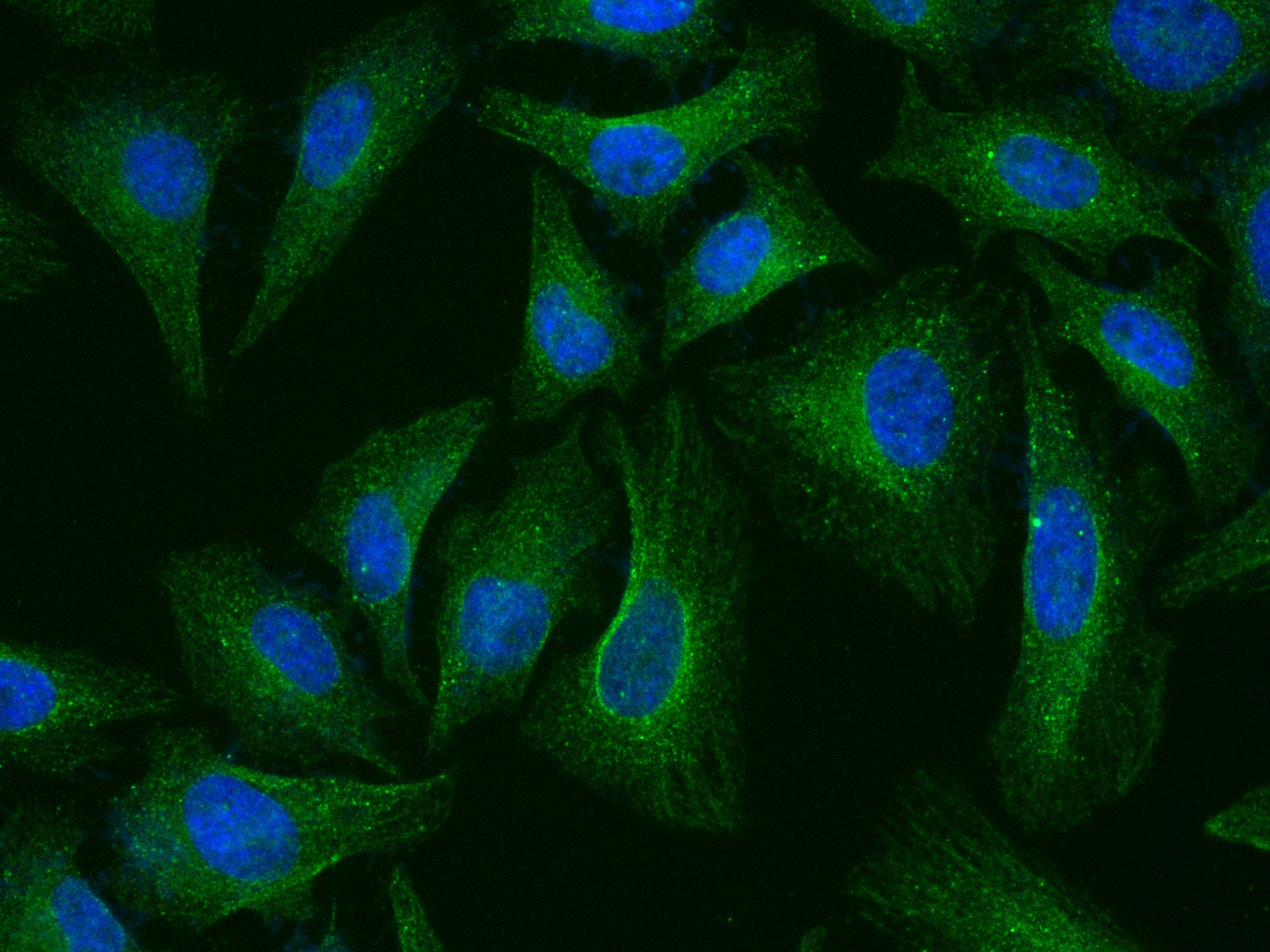 Immunofluorescence (IF) / fluorescent staining of HeLa cells using PEX14 (human specific) Recombinant antibody (80196-1-RR)