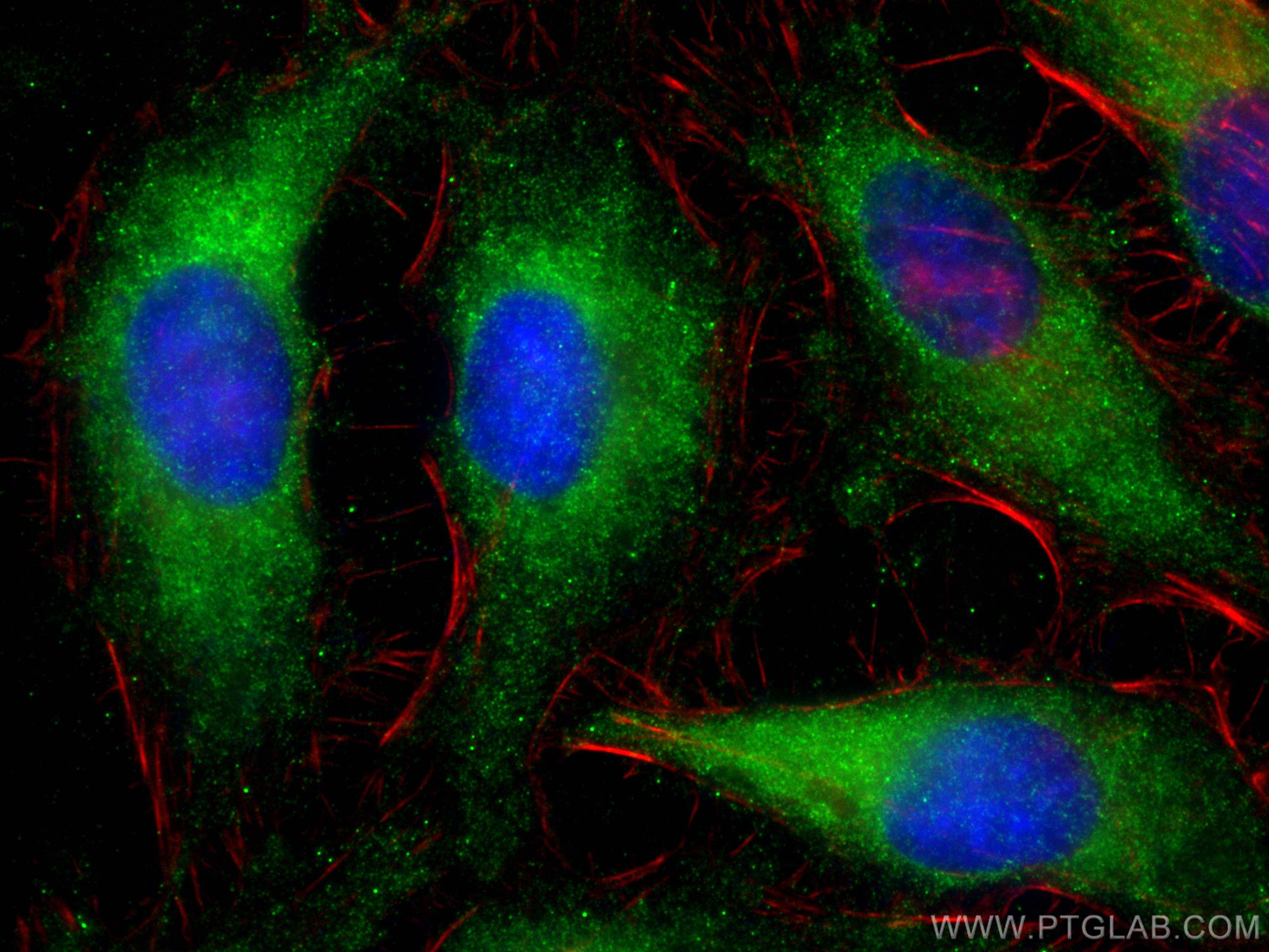 Immunofluorescence (IF) / fluorescent staining of HeLa cells using PEX19 Monoclonal antibody (68555-1-Ig)