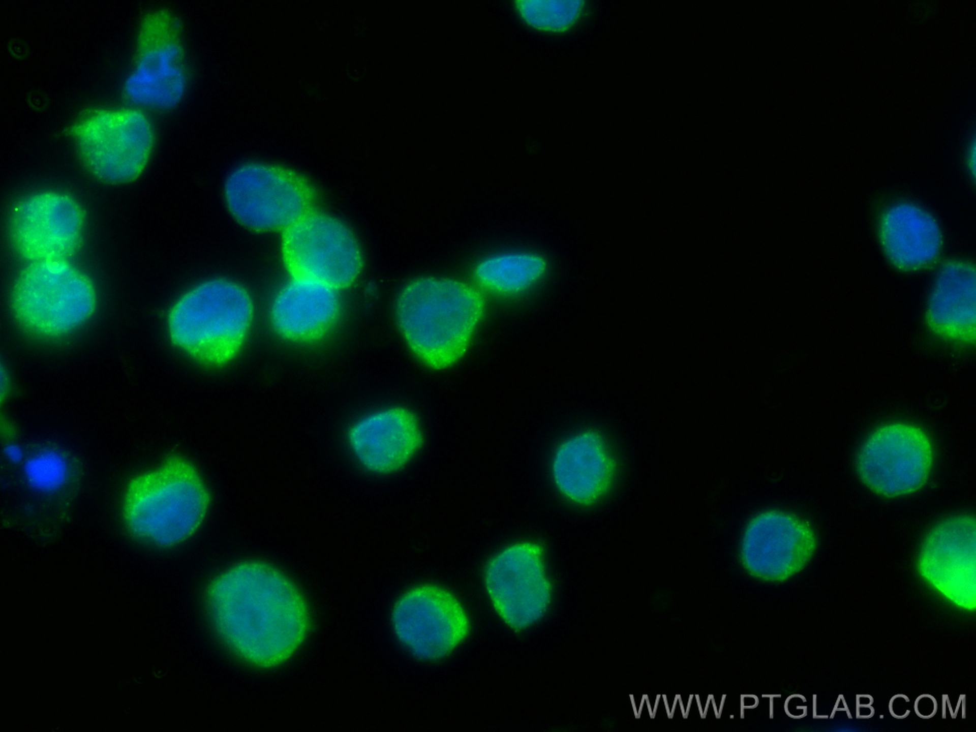 Immunofluorescence (IF) / fluorescent staining of Jurkat cells using PEX19 Monoclonal antibody (68555-1-Ig)