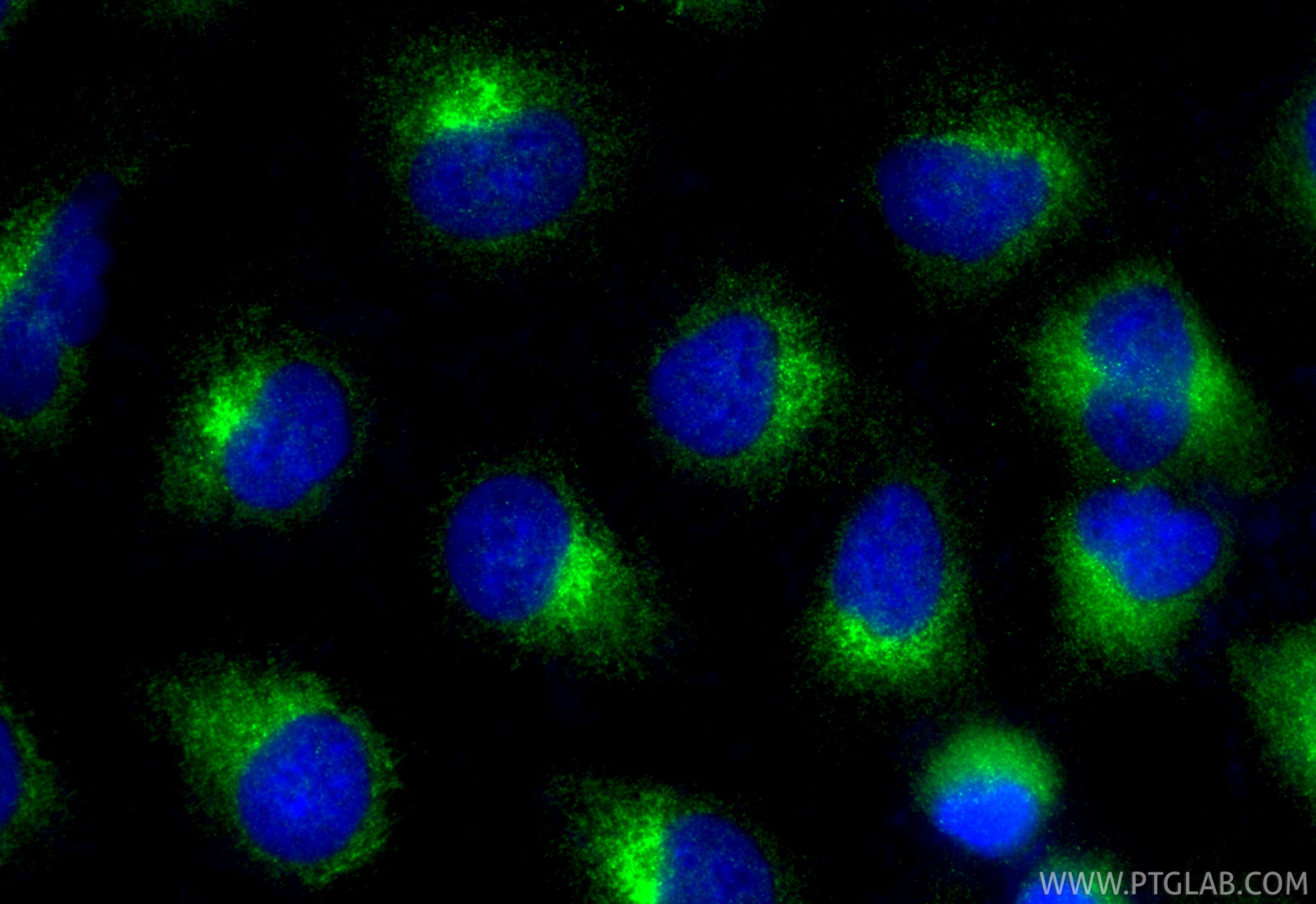 Immunofluorescence (IF) / fluorescent staining of A549 cells using PEX5 Polyclonal antibody (12545-1-AP)