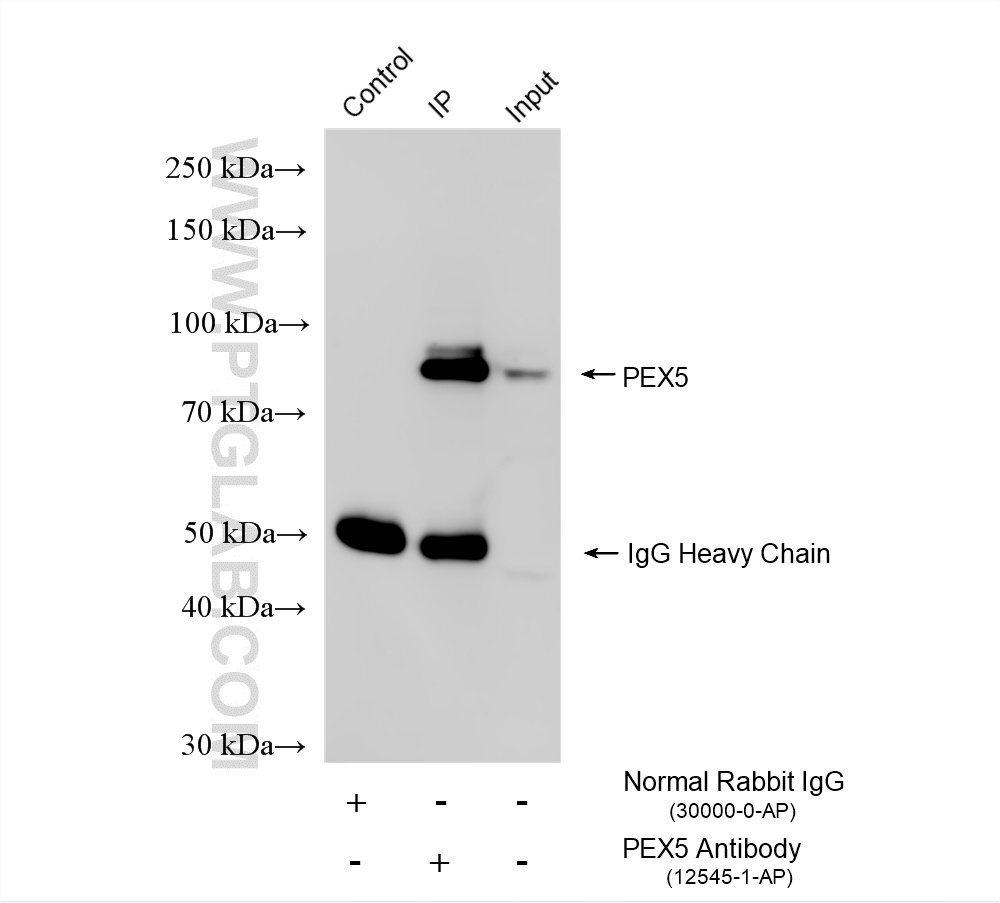Immunoprecipitation (IP) experiment of Raji cells using PEX5 Polyclonal antibody (12545-1-AP)