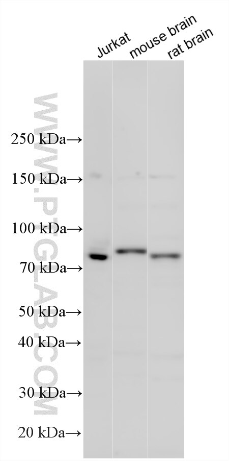 Western Blot (WB) analysis of various lysates using PEX5 Polyclonal antibody (12545-1-AP)